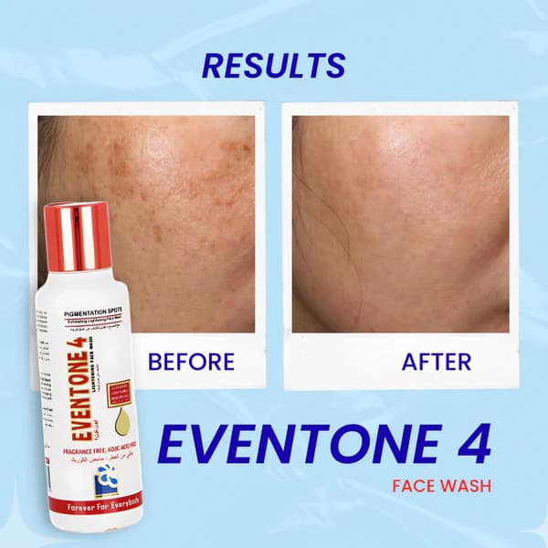 Eventone 4 Face Wash ( Helps in reducing blemishes, pigmentation and nourishes the skin )